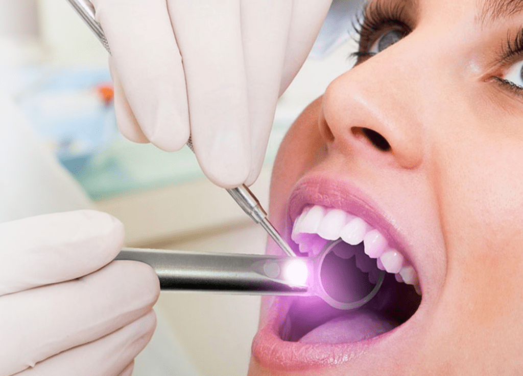 Laser Dentistry in Vancouver