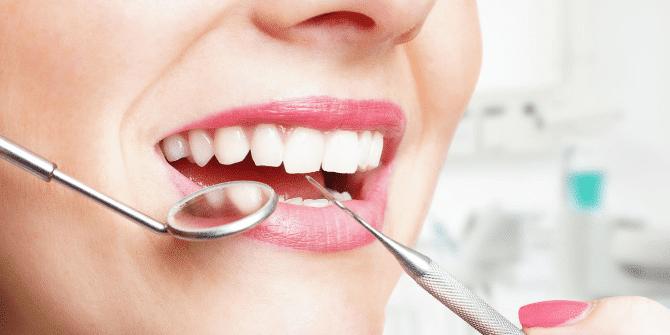 Metal Free Composite Fillings in Vancouver